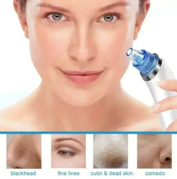 Вакуумний очищувач пор від чорних точок Derma Suction 0262 фото