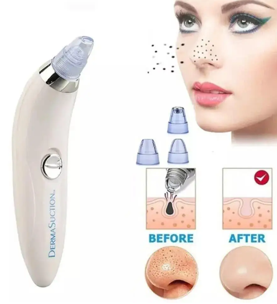 Вакуумный очиститель пор от черных точек Derma Suction 0262 фото