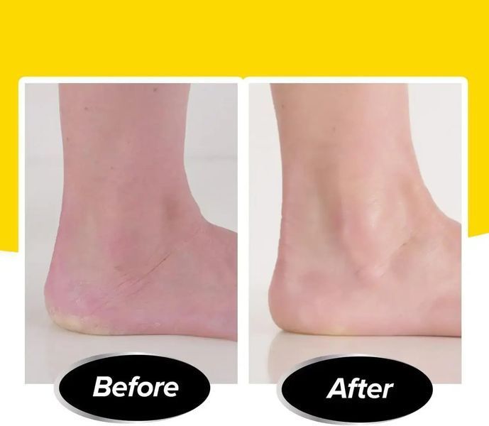 Акумуляторна пемза Remove Calluses для ефективного видалення мозолів та догляду за п&rsquo;ятами 0784 фото
