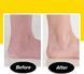 Акумуляторна пемза Remove Calluses для ефективного видалення мозолів та догляду за п&rsquo;ятами 0784 фото 3